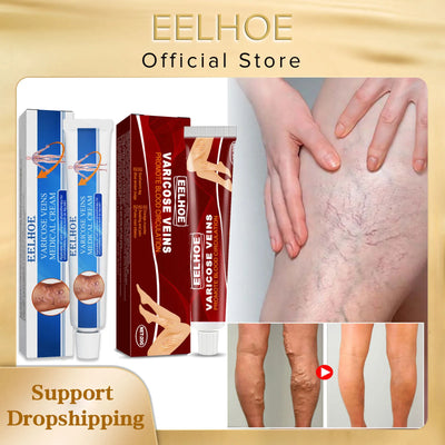 EELHOE Varicose Veins Treatment Cream Spider Veins Earthworm Leg Pain Repair Cream Blood Silk Spider Leg Ointment Health Care