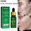 Acne Treatment Facial Serum Pore Shrinking Skin Care Against Face Acne Pimple Spots Remover Cleaning Shrink pores Tea Tree Serum