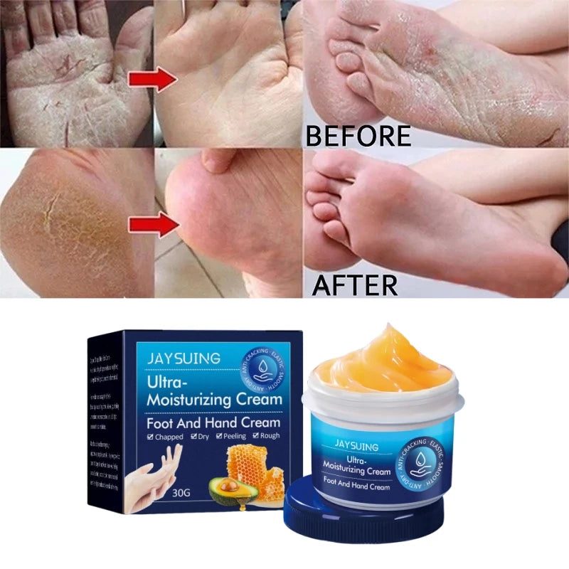 30g Anti Chapping Hand Cream Ultra Moisturizing Dead Skin Removal Repairing Also for Foot Use Non-Sticky Orange Scent Skincare