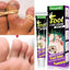 Foot Fungus Removal Cream Anti Fungal Infection Onychomycosis Paronychia Remove Beriberi Dead Skin Repair Foot Cracked Feet Care