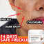 Glutathione Whitening Freckle Face Cream Remove Dark Spots Lighten Melasma Melanin Fade Acne Scars Anti-Aging Brighten Skin Care