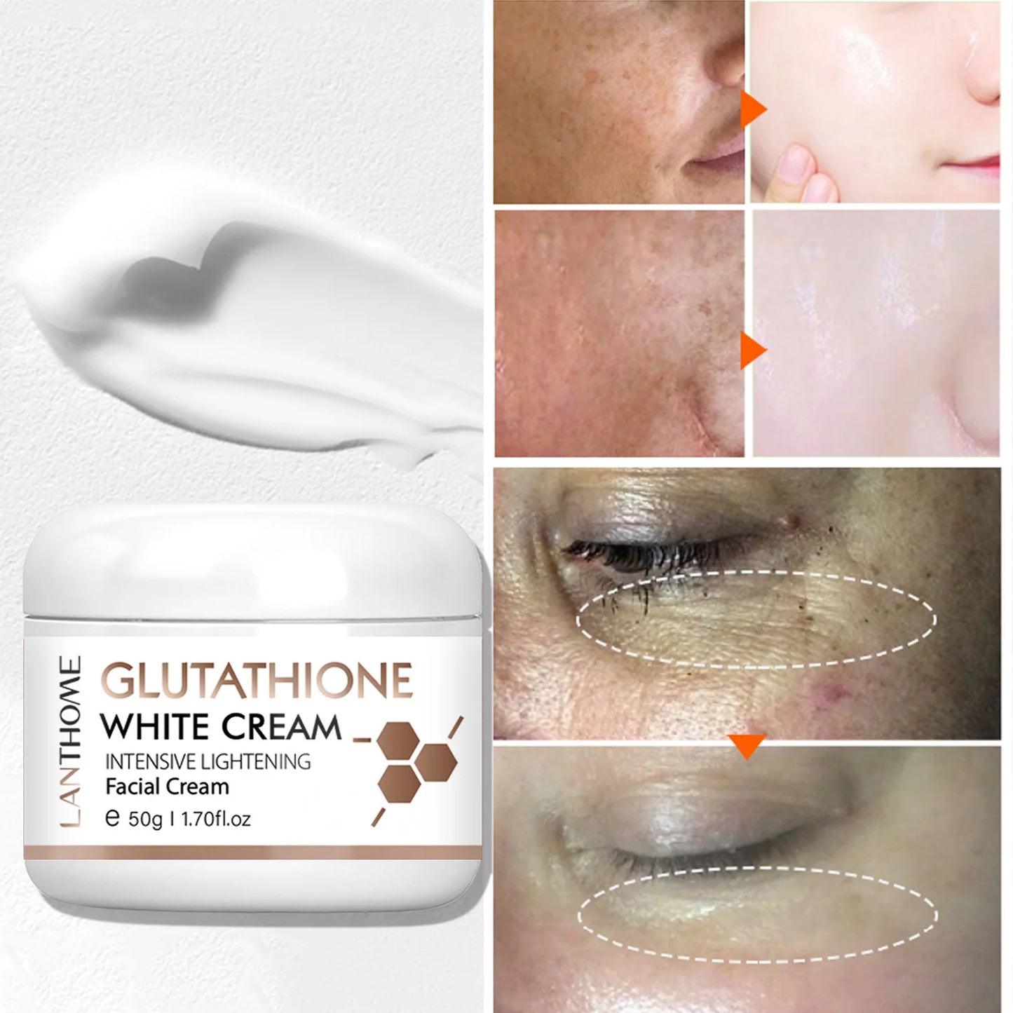 Glutathione Whitening Freckle Face Cream Remove Dark Spots Lighten Melasma Melanin Fade Acne Scars Anti-Aging Brighten Skin Care