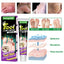 Foot Fungus Removal Cream Anti Fungal Infection Onychomycosis Paronychia Remove Beriberi Dead Skin Repair Foot Cracked Feet Care