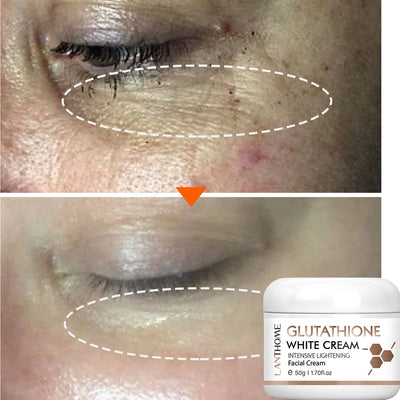 Glutathione Whitening Freckle Face Cream Remove Dark Spots Lighten Melasma Melanin Fade Acne Scars Anti-Aging Brighten Skin Care