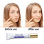 EELHOE Pro. W Blemish Cream Anti Acne Reduce Blemishes Removal Moisturizing Facial Cream Spots Reduce Cream Face Skin Care