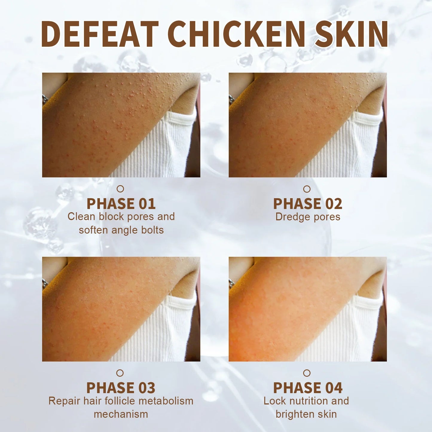 Herbal Repair Chicken Skin Cream Curing Keratosis Pilaris Follicle Cuticle Remove Thick Pore Dark Spot Moisturizin Smooth Lotion