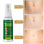 Effective Remove Stretch Mark Spray Removal Postpartum Obesity Pregnant Women Repair Anti-Aging Anti-Winkles Firming Body Care