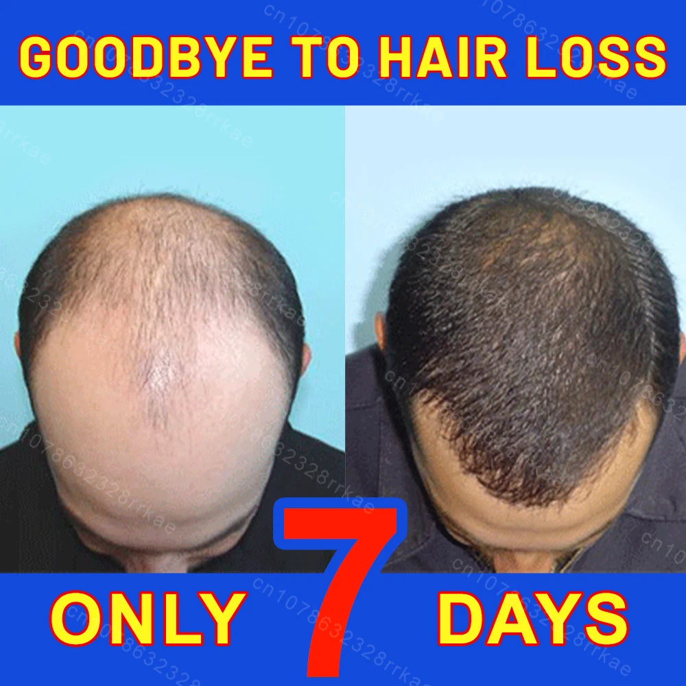 Hair growth products Fast Hair Growth Hair care Repair hair Anti-hair loss