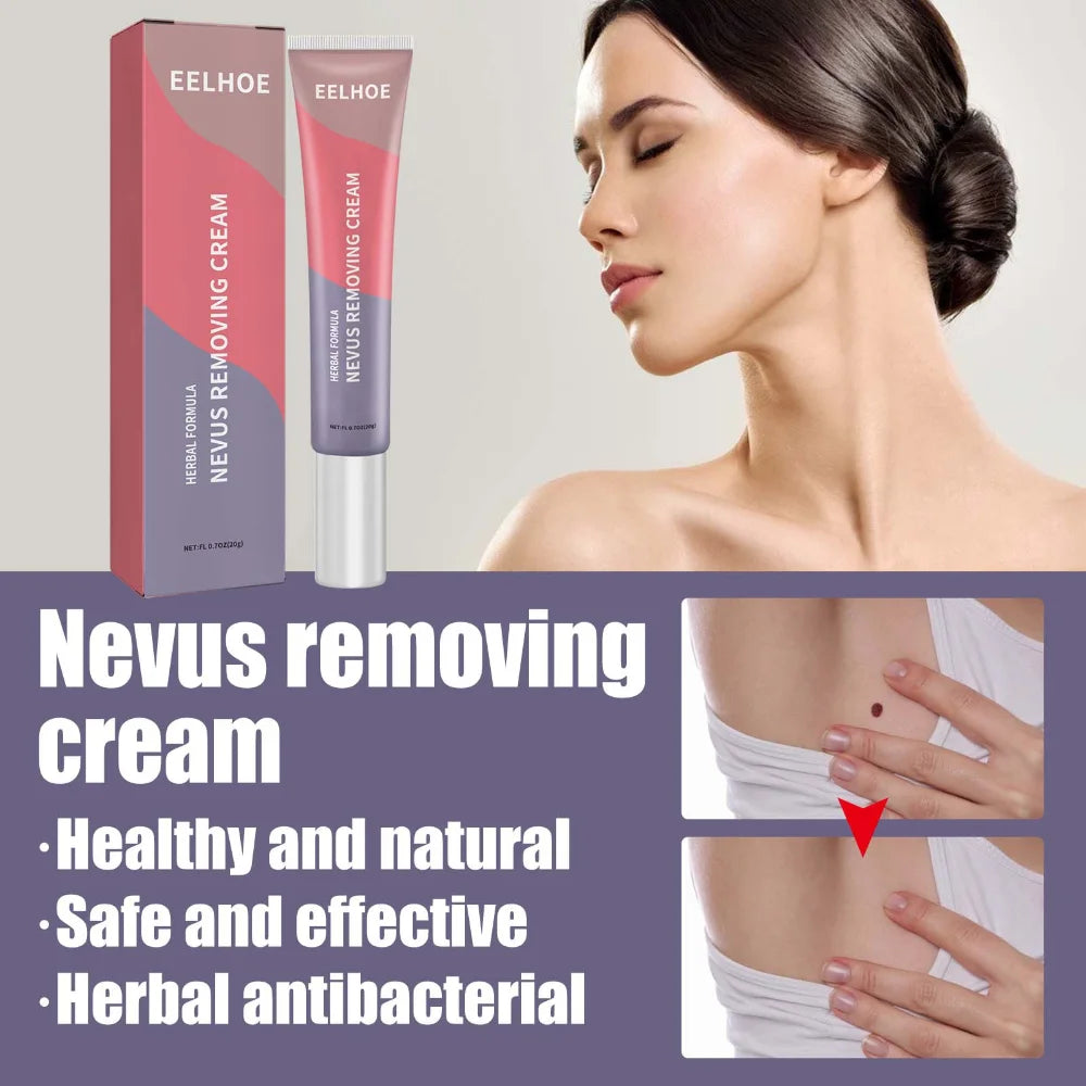 Nevus removing ointment skin cleaning nevus removing ointment hand foot face meat particles neck removing gel