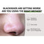 Acne Pimple Patch Sticker Acne Pimple Remover Blemish Spot Facial Mask Skin Care Clean Blackhead Acne Nose Patch Masks