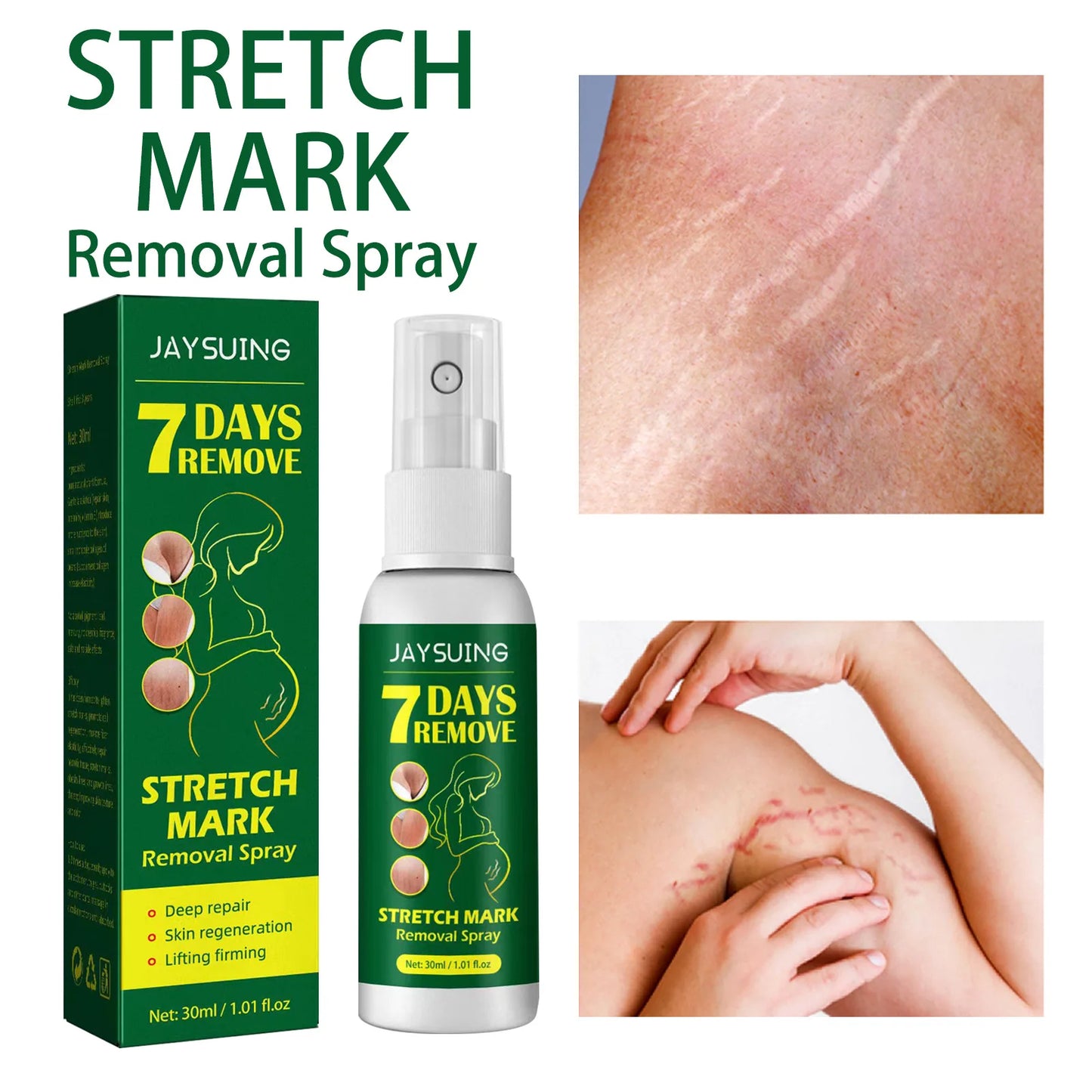 Effective Remove Stretch Mark Spray Removal Postpartum Obesity Pregnant Women Repair Anti-Aging Anti-Winkles Firming Body Care