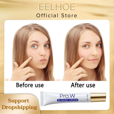 EELHOE Pro. W Blemish Cream Anti Acne Reduce Blemishes Removal Moisturizing Facial Cream Spots Reduce Cream Face Skin Care