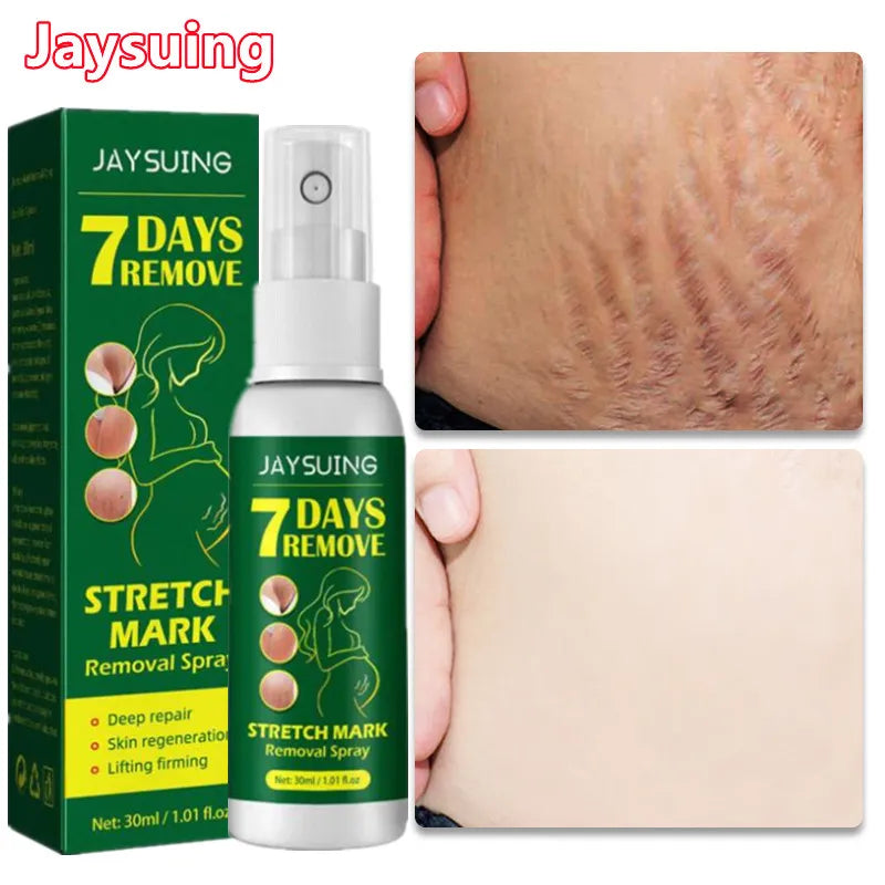 Effective Remove Stretch Mark Spray Removal Postpartum Obesity Pregnant Women Repair Anti-Aging Anti-Winkles Firming Body Care